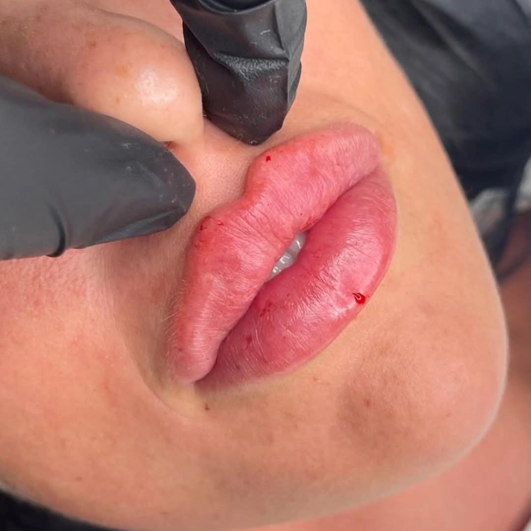 Tratamiento estético premium